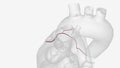 Sinoatrial branch of right coronary artery