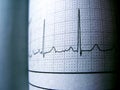 Sinus Heart Rhythm On Electrocardiogram Record Paper