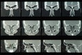 Sinus MRI Royalty Free Stock Photo