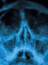 Sinus X-ray Royalty Free Stock Photo