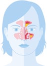 Sinusitis, vector illustration