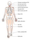 Sites of RA