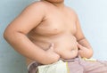 The size of stomach of children with overweight.