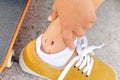 Skateboard injury