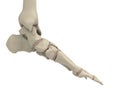 Skeletal foot