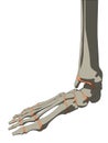 Skeletal foot