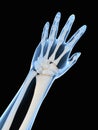 Skeletal hand