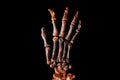 Skeletal hand