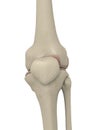 Skeletal knee