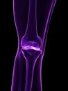 Skeletal knee