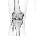 the skeletal knee Royalty Free Stock Photo