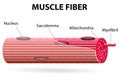 The skeletal muscle fiber