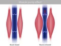 Skeletal Muscle pump effect. Illustration of muscle pump effect on venous return and muscle blood. Calf Muscles