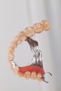 Skeletal prosthesis - art of dentsitry