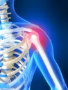 Skeletal shoulder with pain