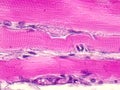 Skeletal striated muscle tissue under the microscope