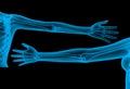 Skeleton arm x-ray render Royalty Free Stock Photo
