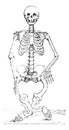 Skeleton deformed by rickets, vintage engraving