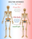 Skeleton differences image Royalty Free Stock Photo