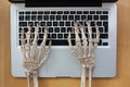 Skeleton hands typing on laptop.