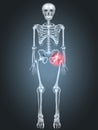 Skeleton with Hip pain Royalty Free Stock Photo