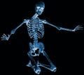 Skeleton kneel x ray Royalty Free Stock Photo