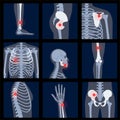 Skeleton x ray