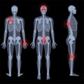 Skeleton x ray Royalty Free Stock Photo