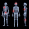 Skeleton x ray Royalty Free Stock Photo