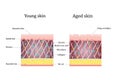 Vector illustration of age-related changes in the skin. Comparison of young and old skin. Structure human skin with Royalty Free Stock Photo