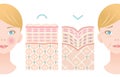 Info graphic skin layer illustration of young skin and old skin with woman face. beauty and skin care concept