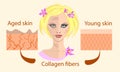 Skin aging diagrams. young skin is firm tight, its collagen Vector illustration with a face and two types of skin