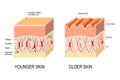 Skin aging. difference between the skin of a young and elderly p