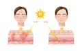 Skin Anatomy Sun Radiation Infographics