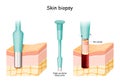 Skin Biopsy. Punch biopsy take skin sample Royalty Free Stock Photo