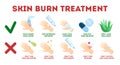Skin burn injury treatment infographic. First aid for damage Royalty Free Stock Photo