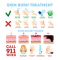 Skin burn injury treatment and stages infographic Royalty Free Stock Photo