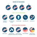 Skin burn stages infographics and treatment. Thermal burns types, burning hands and medical care. Safety of fire, body