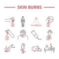 Skin Burns kine icons. Treatment. Vector illustrations