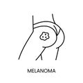 Skin cancer melanoma line icon vector cancer malignant disease on the buttock