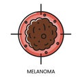 Skin cancer melanoma line icon vector cancer malignant disease Royalty Free Stock Photo