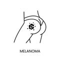 Skin cancer melanoma line icon vector cancer malignant disease on the buttock
