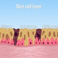 Skin cells layer as Health care and science concept. vector illustration Royalty Free Stock Photo