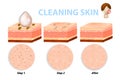 Skin cleaning steps.