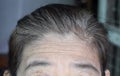 Skin creases or wrinkles at forehead of Southeast Asian, Myanmar or Burmese elder woman. Symptom of aging