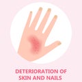 Skin deterioration. Idea of health and body