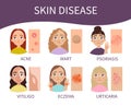 Skin disease Royalty Free Stock Photo