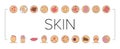 Skin Disease Symptom Collection Icons Set Vector . Royalty Free Stock Photo