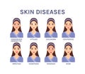 Skin Diseases. Beautiful woman with face skin problems. Flat cartoon color style. White background. Vector stock illustration