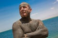 Skin diseases treatment with Dead Sea mud